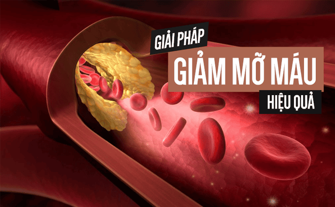 Các Cách Tự Nhiên Giúp Giảm Mỡ Máu