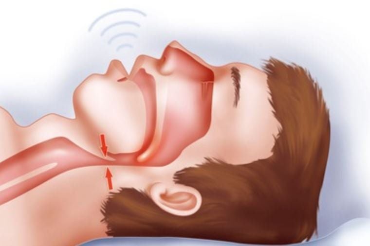 Chẩn đoán và điều trị