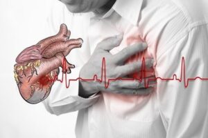 Chẩn đoán và điều trị nhồi máu cơ tim