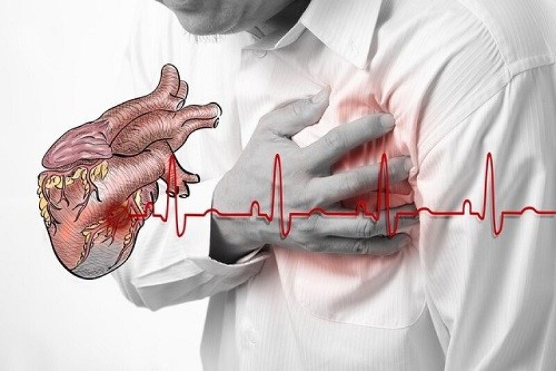 Chẩn đoán và điều trị nhồi máu cơ tim